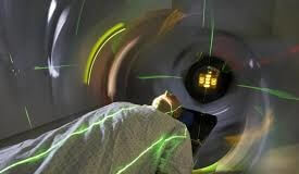 radiotherapy-side-effects