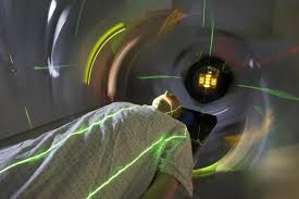 radiotherapy-side-effects